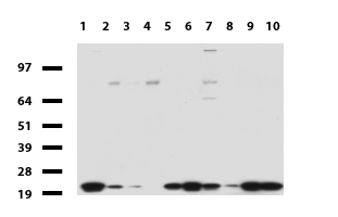 NME1 / NM23 Antibody - Western blot of human tissue lysates. (15ug) from 10 different tissues. (1: Testis, 2: Omentum, 3: Uterus, 4: Breast, 5: Brain, 6: Liver, 7: Ovary, 8: Thyroid, 9: Colon, 10: Spleen ). Diluation: 1:500.