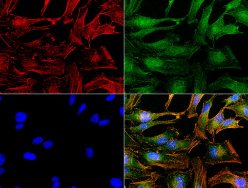 NME1 / NM23 Antibody - Immunofluorescent staining of HeLa cells using NME1 mouse monoclonal antibody  green). Actin filaments were labeled with TRITC-phalloidin. (red), and nuclear with DAPI. (blue). The three-color overlay image is located at the bottom-right corner.