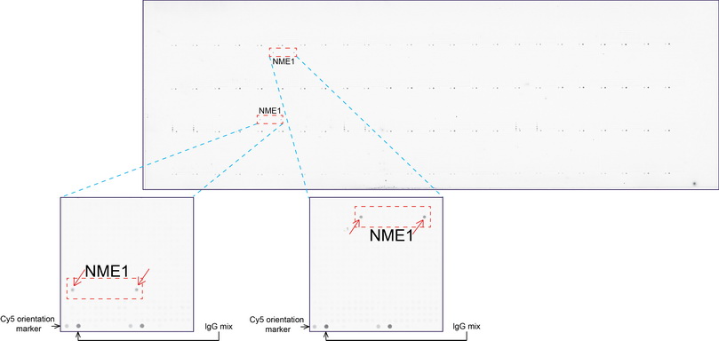 NME1 / NM23 Antibody - OriGene overexpression protein microarray chip was immunostained with UltraMAB anti-NME1 mouse monoclonal antibody. The positive reactive proteins are highlighted with two red arrows in the enlarged subarray. All the positive controls spotted in this subarray are also labeled for clarification.