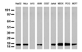 NME1 / NM23 Antibody - Western blot analysis of extracts. (35ug) from 9 different cell lines by using anti-NME1 monoclonal antibody. (Clone UMAB93).