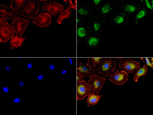 NME1 / NM23 Antibody - Immunofluorescent staining of A549 cells using NME1 mouse monoclonal antibody  green). Actin filaments were labeled with TRITC-phalloidin. (red), and nuclear with DAPI. (blue). The three-color overlay image is located at the bottom-right corner.
