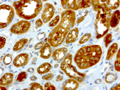 NME1 / NM23 Antibody - Immunohistochemical staining of paraffin-embedded human kidney using anti-NME1 clone UMAB94 mouse monoclonal antibody  at 1:4000 with Polink2 Broad HRP DAB detection kit; heat-induced epitope retrieval with GBI ACCEL pH8.7 HIER buffer using pressure chamber for 3 minutes at 110C. Cytoplasmic staining is very strong in the tubule epithleial cells of the kidney.