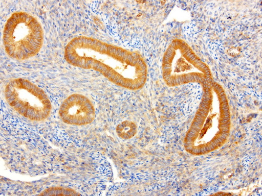 NME1 / NM23 Antibody - Immunohistochemical staining of paraffin-embedded human normal adjacent endometruim using anti-NME1 clone UMAB94 mouse monoclonal antibody  at 1:8000 with Polink2 Broad HRP DAB detection kit; heat-induced epitope retrieval with GBI ACCEL pH8.7 HIER buffer using pressure chamber for 3 minutes at 110C. Cytoplasmic staining is very strong in the glandular epithelial cells and weaker stain was seen in the stromal cells.