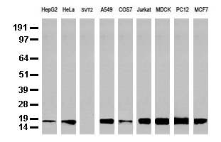 NME1 / NM23 Antibody - Western blot analysis of extracts. (35ug) from 9 different cell lines by using anti-NME1 monoclonal antibody. (Clone UMAB94).