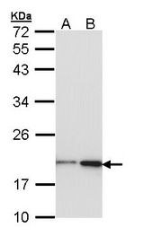NME1 / NM23 Antibody - Sample (30 ug of whole cell lysate). A: Hep G2. B: Molt-4. 12% SDS PAGE. NME1 antibody diluted at 1:1000. 