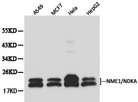 NME1 / NM23 Antibody - Western blot of NME1(NDKA) pAb in extracts from A549, MCF7, Hela and HepG2 cells.