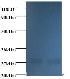 NME1 / NM23 Antibody - Western blot of Nucleoside diphosphate kinase A antibody at 2 ug/ml. Lane 1:293T whole cell lysate. Lane 2: EC109 whole cell lysate. Secondary: Goat polyclonal to Rabbit IgG at 1:15000 dilution. Predicted band size:16.7 kDa. Observed band size: 32 kDa.  This image was taken for the unconjugated form of this product. Other forms have not been tested.