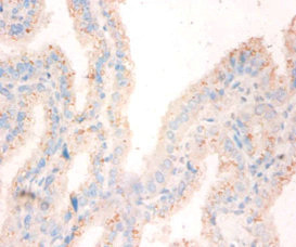 NME1 / NM23 Antibody - Immunohistochemistry of paraffin-embedded human small intestine tissue using NME1 Antibody at dilution of 1:50