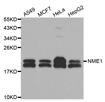 NME1 / NM23 Antibody - Western blot analysis of extracts of various cell lines, using NME1 antibody at 1:1000 dilution. The secondary antibody used was an HRP Goat Anti-Rabbit IgG (H+L) at 1:10000 dilution. Lysates were loaded 25ug per lane and 3% nonfat dry milk in TBST was used for blocking.