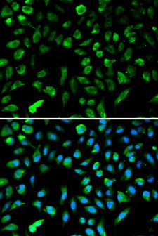 NME1 / NM23 Antibody - Immunofluorescence analysis of A549 cells using NME1 antibody. Blue: DAPI for nuclear staining.