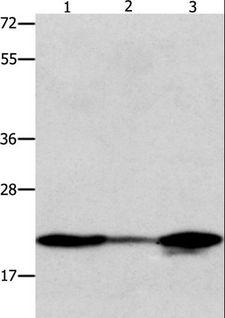 NME1 / NM23 Antibody - Western blot analysis of 231 and A549 cell, human liver cancer tissue, using NME1 Polyclonal Antibody at dilution of 1:600.