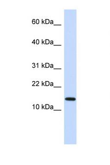 NME1 / NM23 Antibody - NME1 antibody Western blot of Fetal Heart lysate. Antibody concentration 1 ug/ml. This image was taken for the unconjugated form of this product. Other forms have not been tested.