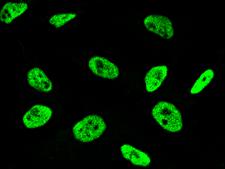 NME1 / NM23 Antibody - Immunofluorescence staining of NME1 in HeLa cells. Cells were fixed with 4% PFA, permeabilzed with 0.3% Triton X-100 in PBS, blocked with 10% serum, and incubated with rabbit anti-human NME1 polyclonal antibody (dilution ratio: 1:1000) at 4°C overnight. Then cells were stained with the Alexa Fluor 488-conjugated Goat Anti-rabbit IgG secondary antibody (green). Positive staining was localized to nucleus.