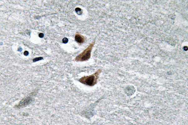NME1 / NM23 Antibody - IHC of NM23-H1 (Y52) pAb in paraffin-embedded human brain tissue.