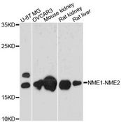 NME1-NME2 Antibody - Western blot analysis of extracts of various cell lines, using NME1-NME2 antibody at 1:3000 dilution. The secondary antibody used was an HRP Goat Anti-Rabbit IgG (H+L) at 1:10000 dilution. Lysates were loaded 25ug per lane and 3% nonfat dry milk in TBST was used for blocking. An ECL Kit was used for detection and the exposure time was 30s.