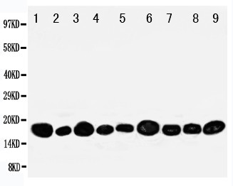 NME2 Antibody - WB of NME2 / NM23 antibody. All lanes: Anti-NME2 at 0.5ug/ml. Lane 1: Rat Heart Tissue Lysate at 40ug. Lane 2: Rat Brain Tissue Lysate at 40ug. Lane 3: Rat Liver Tissue Lysate at 40ug. Lane 4: Rat Skeletal Muscle Tissue Lysate at 40ug. Lane 5: PANC Whole Cell Lysate at 40ug. Lane 6: HELA Whole Cell Lysate at 40ug. Lane 7: SMMC Whole Cell Lysate at 40ug. Lane 8: U87 Whole Cell Lysate at 40ug. Lane 9: COLO320 Whole Cell Lysate at 40ug. Predicted bind size: 17KD. Observed bind size: 17KD.