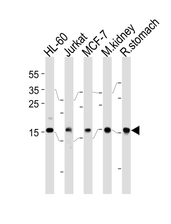 NME2 Antibody - NME2 Antibody (F40) western blot of HL-60,Jurkat,MCF-7 cell line,mouse kidney and rat stomach tissue lysates (35 ug/lane). The NME2 antibody detected the NME2 protein (arrow).