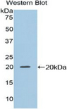 NME2 Antibody - Western blot of recombinant NME2 / NM23.  This image was taken for the unconjugated form of this product. Other forms have not been tested.