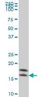 NME2 Antibody - NME2 monoclonal antibody (M06), clone 1D3 Western blot of NME2 expression in HeLa.