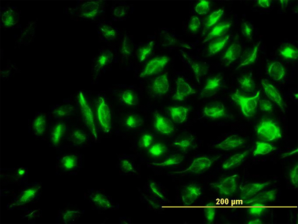 NME2 Antibody - Immunofluorescence of monoclonal antibody to NME2 on HeLa cell. [antibody concentration 10 ug/ml]