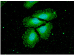 NME2 Antibody - ICC/IF analysis of NME2 in HeLa cells. The cell was stained with NME2 antibody (1:100).The secondary antibody (green) was used Alexa Fluor 488. DAPI was stained the cell nucleus (blue).