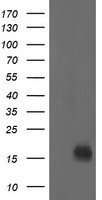 NME2 Antibody - HEK293T cells were transfected with the pCMV6-ENTRY control (Left lane) or pCMV6-ENTRY NME2 (Right lane) cDNA for 48 hrs and lysed. Equivalent amounts of cell lysates (5 ug per lane) were separated by SDS-PAGE and immunoblotted with anti-NME2.