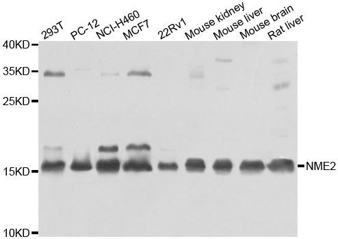 NME2 Antibody - Western blot analysis of extracts of various cell lines.