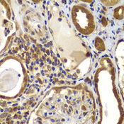 NME2 Antibody - Immunohistochemistry of paraffin-embedded human kidney tissue.