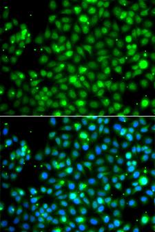 NME2 Antibody - Immunofluorescence analysis of A549 cells.