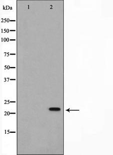 NME2 Antibody - Western blot analysis on K562 cell lysates using NM23 antibody. The lane on the left is treated with the antigen-specific peptide.