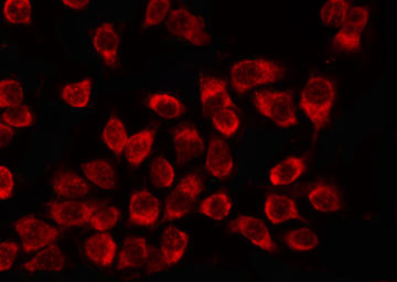 NME2 Antibody - Staining K562 cells by IF/ICC. The samples were fixed with PFA and permeabilized in 0.1% Triton X-100, then blocked in 10% serum for 45 min at 25°C. The primary antibody was diluted at 1:200 and incubated with the sample for 1 hour at 37°C. An Alexa Fluor 594 conjugated goat anti-rabbit IgG (H+L) Ab, diluted at 1/600, was used as the secondary antibody.