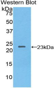 NME3 Antibody - Western blot of recombinant NME3.  This image was taken for the unconjugated form of this product. Other forms have not been tested.