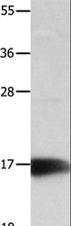NME3 Antibody - Western blot analysis of Mouse kidney tissue, using NME3 Polyclonal Antibody at dilution of 1:800.
