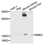 NME3 Antibody - Western blot analysis of extracts of various cells.