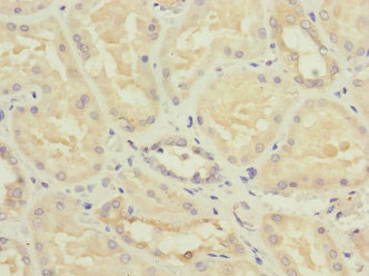 NME3 Antibody - Immunohistochemistry of paraffin-embedded human kidney tissue at dilution 1:100