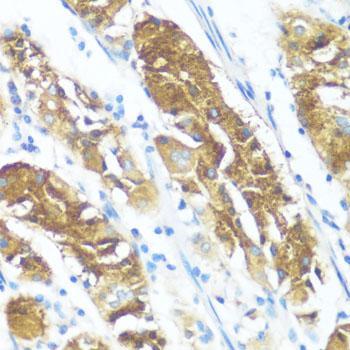 NME3 Antibody - Immunohistochemistry of paraffin-embedded Human stomach using NME3 Polyclonal Antibody at dilution of 1:100 (40x lens).