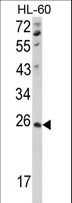 NME4 Antibody - Western blot of hNME4-V173 in HL-60 cell line lysates (35 ug/lane). NME4 (arrow) was detected using the purified antibody.