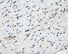 NME4 Antibody - IHC of paraffin-embedded colon tissue using anti-NME4 mouse monoclonal antibody. (Dilution 1:50).