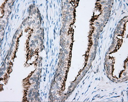 NME4 Antibody - Immunohistochemical staining of paraffin-embedded prostate tissue using anti-NME4 mouse monoclonal antibody. (Dilution 1:50).