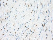 NME4 Antibody - IHC of paraffin-embedded Human colon tissue using anti-NME4 mouse monoclonal antibody. (Dilution 1:50).