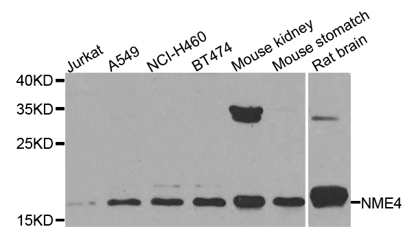 NME4 Antibody - Western blot blot of extracts of various cell lines, using NME4 antibody.