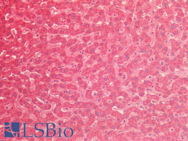 NME4 Antibody - Human Liver: Formalin-Fixed, Paraffin-Embedded (FFPE)