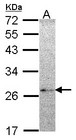 NME5 Antibody - Sample (30 ug of whole cell lysate). A: Hela. 12% SDS PAGE. NME5 antibody. NME5 antibody diluted at 1:1000.