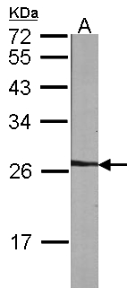 NME5 Antibody - Sample (30 ug of whole cell lysate). A: NIH-3T3. 12% SDS PAGE. NME5 antibody diluted at 1:1000.