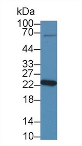 NME5 Antibody - Western Blot; Sample: Mouse Testis lysate; Primary Ab: 1µg/ml Rabbit Anti-Human NME5 Antibody Second Ab: 0.2µg/mL HRP-Linked Caprine Anti-Rabbit IgG Polyclonal Antibody