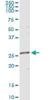 NME5 Antibody - Immunoprecipitation of NME5 transfected lysate using anti-NME5 monoclonal antibody and Protein A Magnetic Bead, and immunoblotted with NME5 rabbit polyclonal antibody.