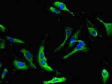 NME5 Antibody - Immunofluorescent analysis of Hela cells using NME5 Antibody at dilution of 1:100 and Alexa Fluor 488-congugated AffiniPure Goat Anti-Rabbit IgG(H+L)