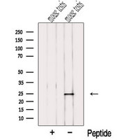 NME5 Antibody - Western blot analysis of extracts of mouse testis tissue using NME5 antibody. The lane on the left was treated with blocking peptide.
