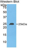 NME6 Antibody - Western blot of recombinant NME6.  This image was taken for the unconjugated form of this product. Other forms have not been tested.