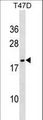 NME6 Antibody - NME6 Antibody western blot of T47D cell line lysates (35 ug/lane). The NME6 antibody detected the NME6 protein (arrow).